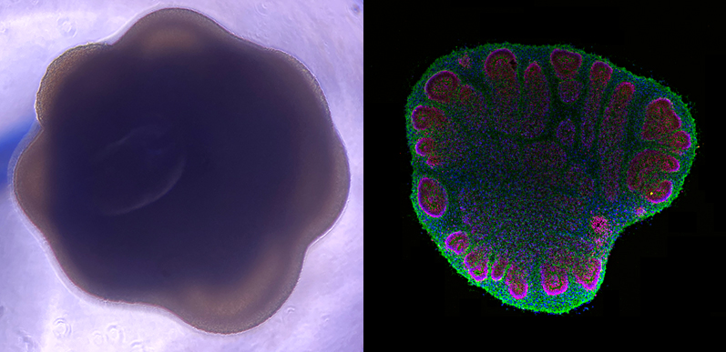 De SupBiotech à la Station spatiale internationale, l’incroyable expérience Cerebral Ageing